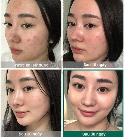 Kem Dưỡng Some By Mi AHA-BHA-PHA 30 Days Miracle Cream 60g