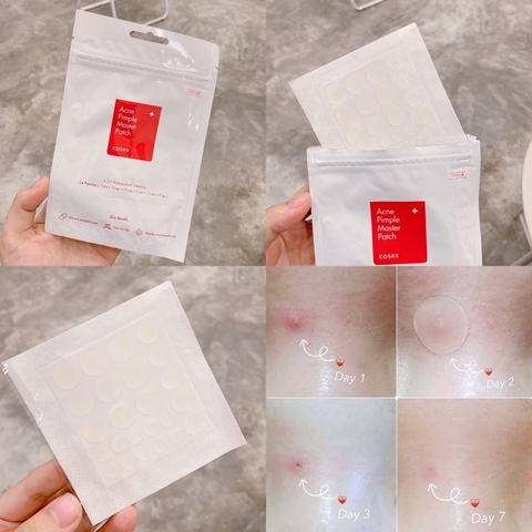 Miếng dán mụn Cosrx Acne Pimple Master Patch 24 miếng (Màu đỏ) và Cosrx The Clear Pit Master Patch 18 miếng (Màu đen)