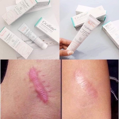 Kem dưỡng Avene Cicalfate Repair Giảm Thâm - Mờ Sẹo - Phục Hồi Da 40ml
