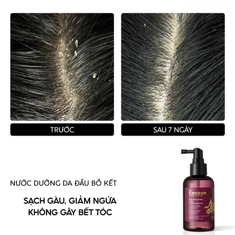 Nước Dưỡng Tóc Bồ Kết Thuần Chay Cocoon Giảm Gàu Cho Da Đầu Nhạy Cảm Gleditsia Scalp Tonic 140ml