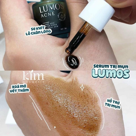Serum Lumos Plus Giúp Sạch Mụn, Làm Mờ Vết Thâm 5ml