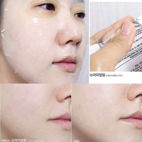 Lẻ 1 Miếng & Combo 10 Miếng Mặt Nạ Giấy BNBG Vita Genic Hàn Quốc