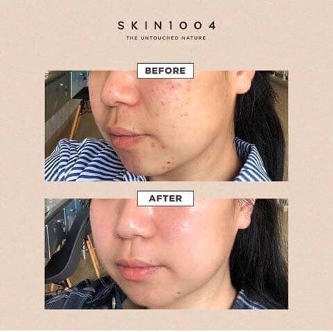 e534 - Tinh Chất Rau Má Skin1004 Madagascar Centella Ampoule 55ml