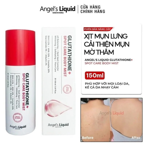 b556 - Angel's Liquid - Xịt mụn lưng Glutathione+ Spot Care Body Mist 50ml