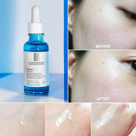 Tinh chất Dưỡng phục hồi La Roche-Posay Hyalu Serum B5 10ml