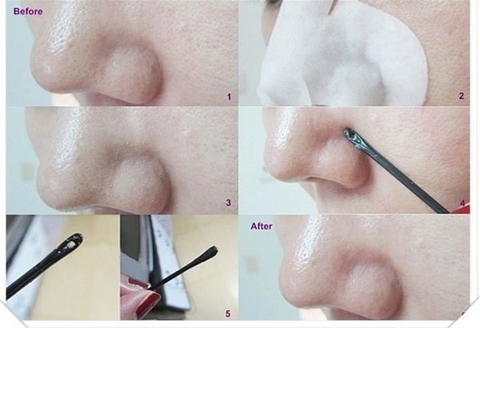 Mặt Nạ Đẩy Mụn dán mụn Đầu Đen Ciracle Goodbye Blackhead Hộp 20 Miếng