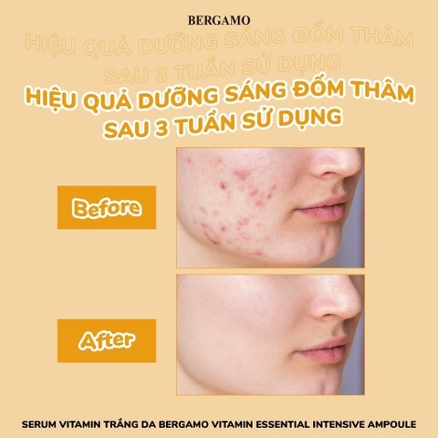 Serum Tinh Chất Bergamo Essential Intensive Ampoule Cấp Ẩm, Giảm Nếp Nhăn, Mờ Thâm Nám Hàn Quốc 150ml