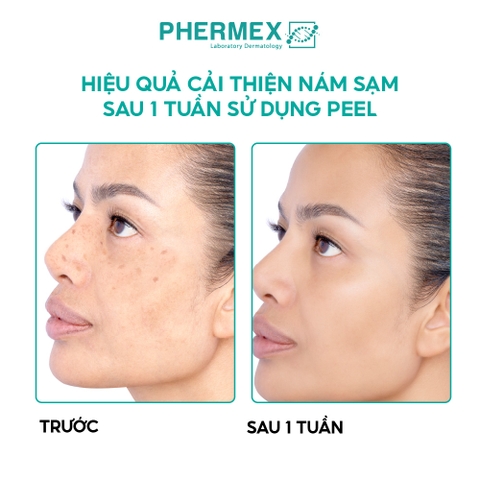 Peel Tế Bào Thế Hệ Mới Tái Sinh Trắng Da Phermex Re.BIO Tech Hỗ Trợ Giảm Mụn, Mờ Thâm Hàn Quốc 1.5g