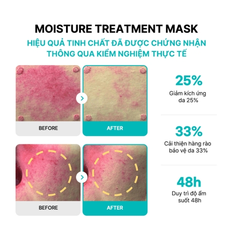 f111 - [Hộp 5 miếng] Mặt Nạ Rejuran Moisture Treatment Mask PDRx c-PDRN Dưỡng Ẩm Phục Hồi 23ml LYO