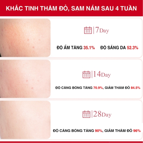 Siêu Tinh Chất Xoá Thâm Đỏ, Mờ Sạm Nám Angel's Liquid Tranexamic Mela Ampoule 30ml
