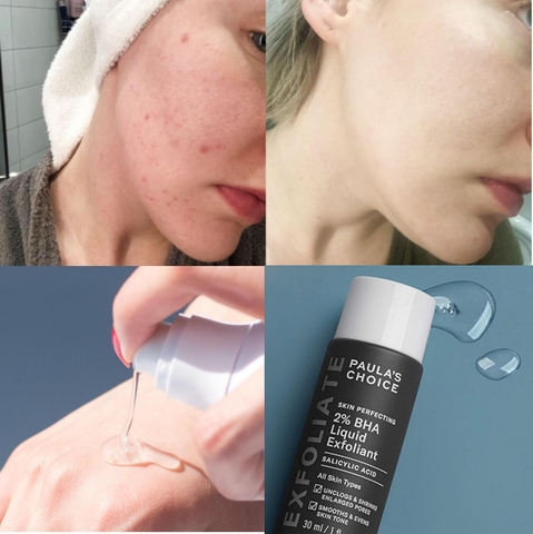 Dung Dịch Tẩy Tế Bào Chết Hóa Học Paula's Choice Skin Perfecting 2% BHA Liquid Exfoliant 30ml