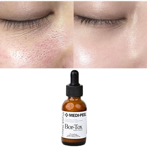 Tinh Chất Chống Nhăn, Căng Bóng Da MEDI-PEEL Bor -Tox Peptide Ampoule 30ml