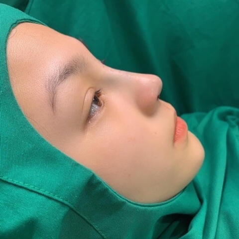 Săng mổ - săng phẫu thuật màu xanh lá cho bệnh viện, thẩm mỹ viện