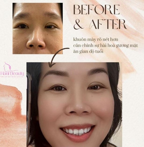 Xăm chân mày – Phương pháp làm đẹp bị “thất sủng” do đâu?