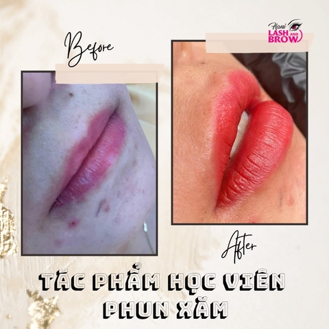 Đào tạo phun xăm thẩm mỹ: Cách xử lý môi bị bầm tím sau phun