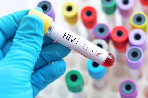 MODERNA BẮT ĐẦU THỬ NGHIỆM VACXIN HIV TRÊN NGƯỜI