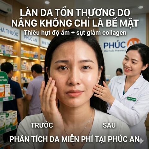 Da sạm, khô sau nắng? Đừng để “xuống tone” kéo dài!