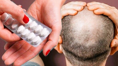 Rụng tóc có thể là tác dụng phụ của thuốc giảm cholesterol