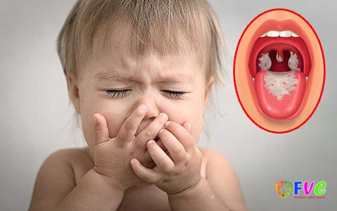 Các loại vắc xin Bạch hầu và những điều cần lưu ý