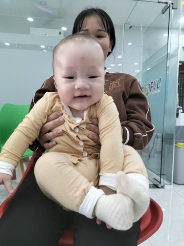 Tiêm phòng lao cho trẻ muộn có ảnh hưởng gì không?