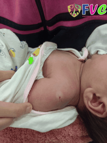 Tiêm phòng lao cho trẻ sơ sinh - những điều cần biết