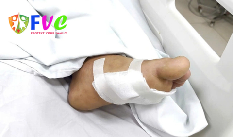 Chủ quan với vết xước nhỏ, nhiều bệnh nhân uốn ván phải nhập viện thở máy