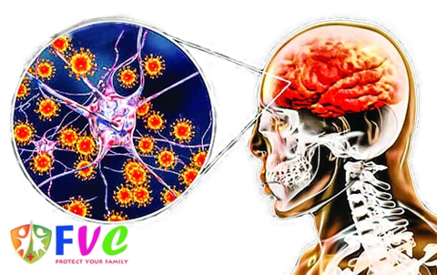 Nhận biết sớm dấu hiệu viêm não virus nguy hiểm