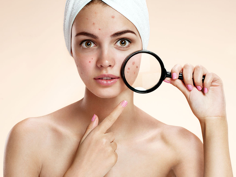 Bật mí 7 bước chăm sóc da mụn giúp phục hồi nhanh chóng