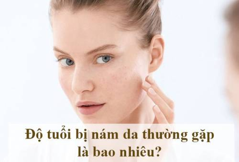 Độ tuổi thường bị nám da. Cách phòng và điều trị