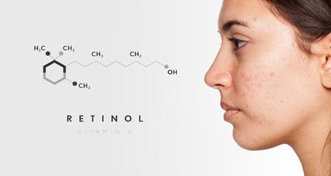 Da nhạy cảm có dùng được Retinol?