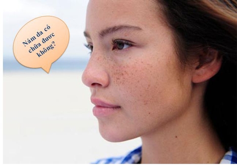 NÁM DA CÓ THỰC SỰ CHỮA ĐƯỢC KHÔNG? CHIA SẺ CỦA BÁC SĨ DA LIỄU