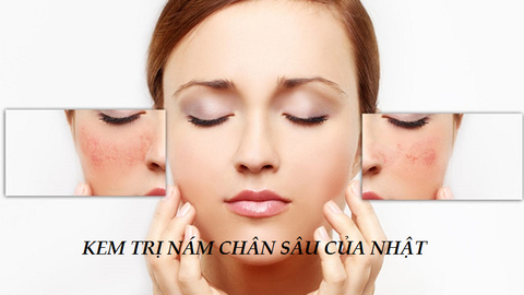 KEM TRỊ NÁM CHÂN SÂU CỦA NHẬT