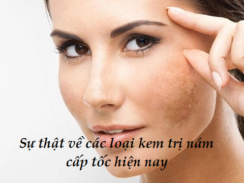 SỰ THẬT VỀ CÁC LOẠI KEM TRỊ NÁM CẤP TỐC HIỆN NAY - CHIA SẺ CỦA BÁC SĨ