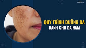 QUY TRÌNH CHĂM SÓC DA NÁM CHUẨN Y KHOA ĐƠN GIẢN TẠI NHÀ
