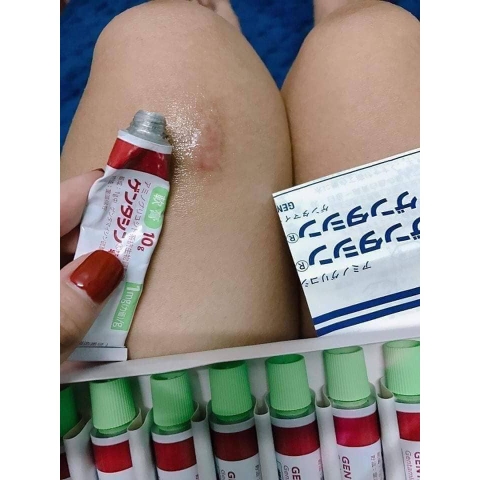 Kem bôi mờ sẹo Gentacin Ointment Nhật