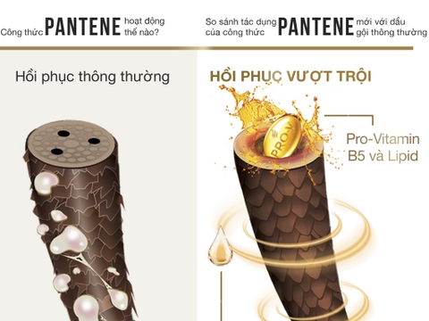 Dầu gội Pantene ngăn rụng tóc 5.8ml x 12 gói