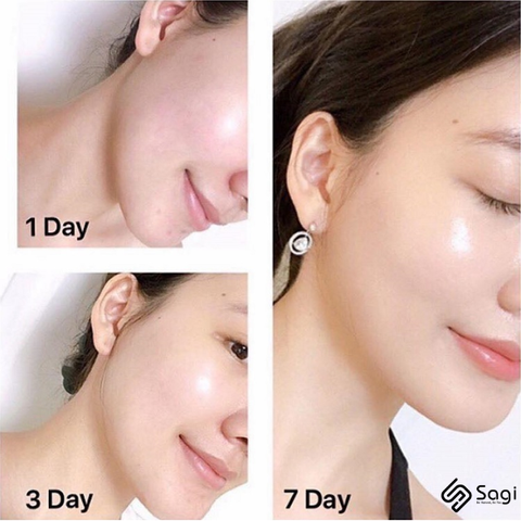 Kem Dưỡng Olay Total Effects 7 in 1 Night Firming Moisturiser 50ml