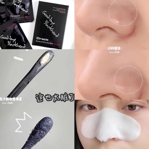 Lột Mụn Đầu Đen Mũi Ciracle Goodbye Blackhead