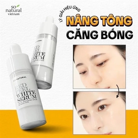 SO NATURAL. Serum Red Peel White Mini 11ml