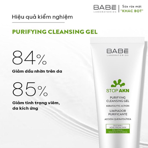 Sữa Rửa Mặt Babe Stop AKN Purifying Cleansing Gel Cho Da Dầu Mụn