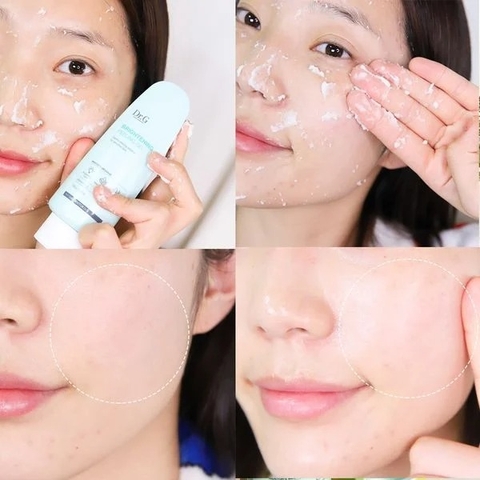 Tẩy da chết dạng gel Dr.G Brightening Peeling Gel 120g