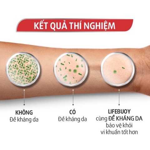 Sữa Tắm Lifebuoy