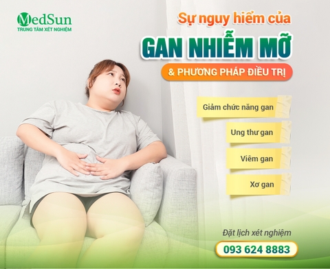 Gan Nhiễm Mỡ Là Gì? Nguy Hiểm Như Thế Nào Và Phương Pháp Điều Trị Tận Gốc