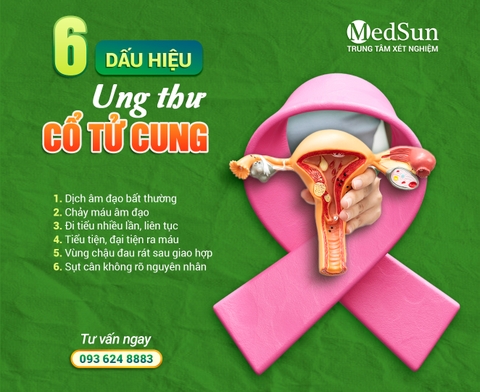 6 Dấu Hiệu Ung Thư Cổ Tử Cung Phụ Nữ Tuyệt Đối Không Được Bỏ Qua