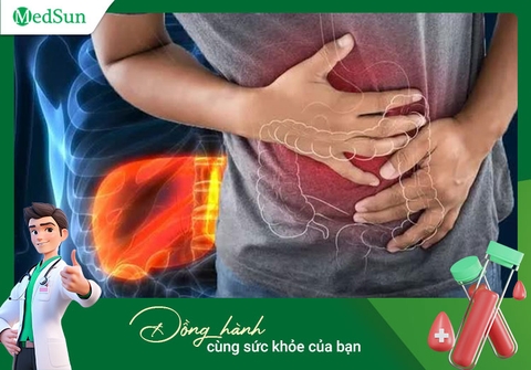 Gói XN Tầm soát Ung thư Nam_Ung thư Gan