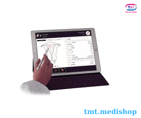 Hệ thống nội soi phẫu thuật buồng tử cung Delmont