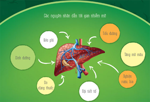 Gan nhiễm mỡ dẫn đến bệnh gì?