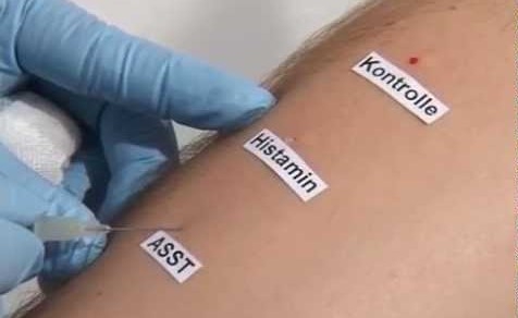 TEST HUYẾT THANH TỰ THÂN