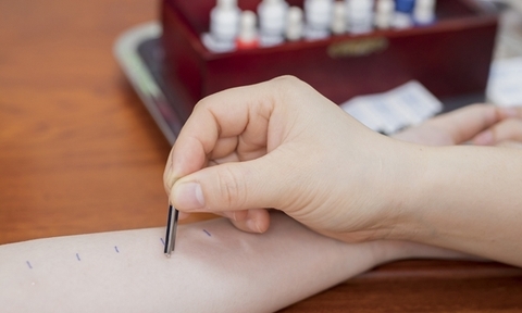 TEST LẨY DA VỚI DỊ NGUYÊN