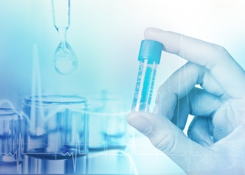 Dự phòng tiên phát tai biến mạch máu não